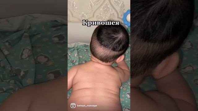 Мойын қисықтығы|Кривошея :до и после смотреть онлайн