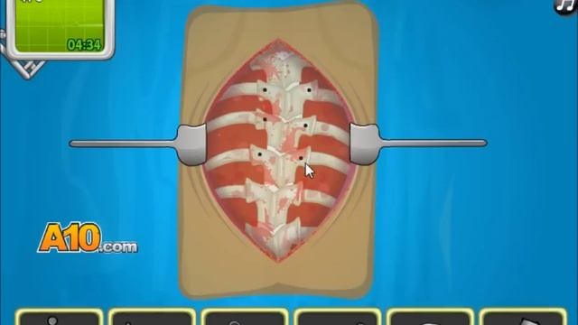 Operate Now: Scoliosis Surgery - walkthrough смотреть онлайн