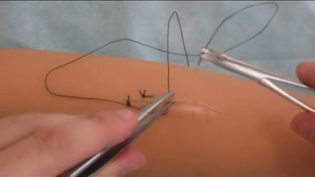 Техника наложения Z-образного шва смотреть онлайн