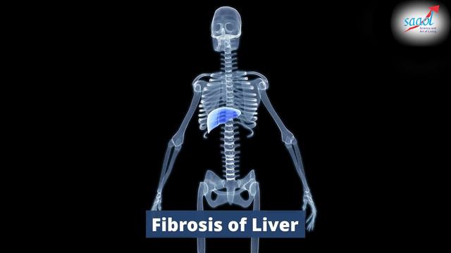 ये 5 चीजें लिवर के लिए अमृत है | 5 Foods That Help To Keep Your Liver Healthy | Dr. Bimal Chhajer смотреть онлайн