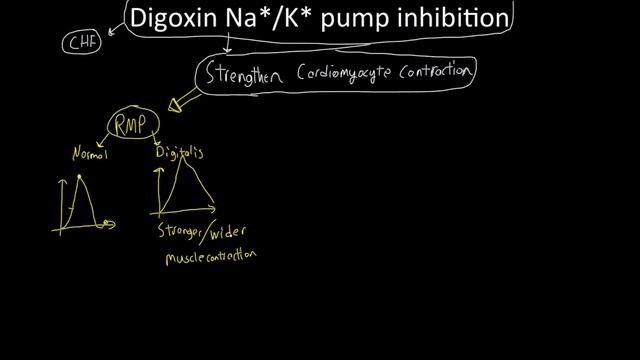 How Digitalis Works for CHF смотреть онлайн
