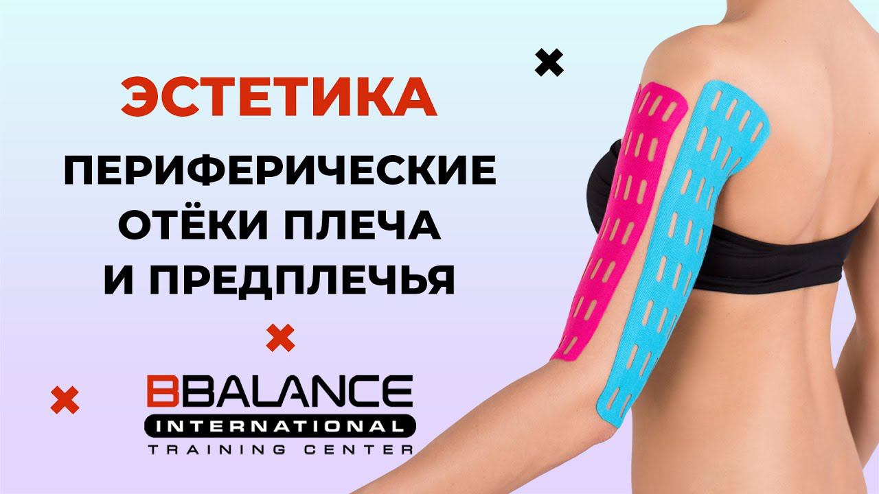 Периферические отёки плеча и предплечья смотреть онлайн