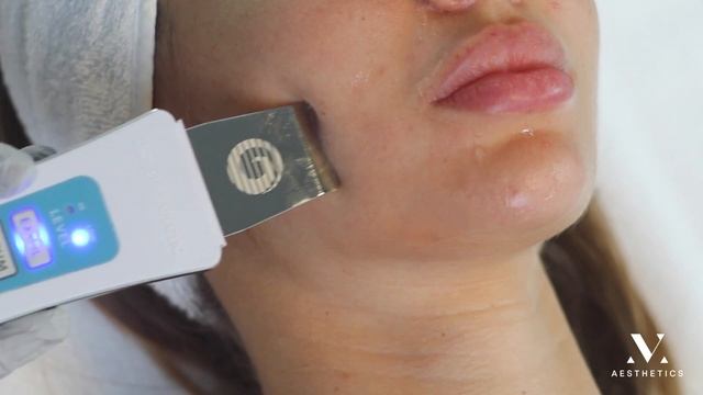 Чистка лица в MV Aestetics смотреть онлайн