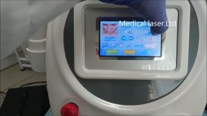 Удаление татуировок лазером - ng001plus обновление 2017 года