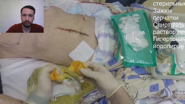 Туалет раны. Toilet of wound. Перевязка. Bandage. Уход за дренажной рубкой. Drenage clean. смотреть онлайн