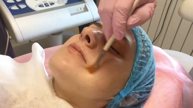 Азелаиновый пилинг Dermatime в Академии Красоты "Атмосфера" смотреть онлайн