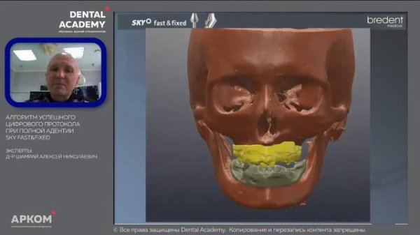 Алгоритм успешного цифрового протокола тотальной реабилитации при полной адентииSKY fast&fixed