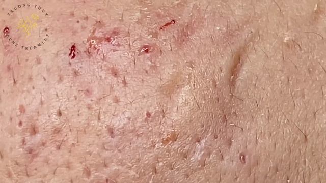 Satisfying Relaxing With Sac Dep Spa #426