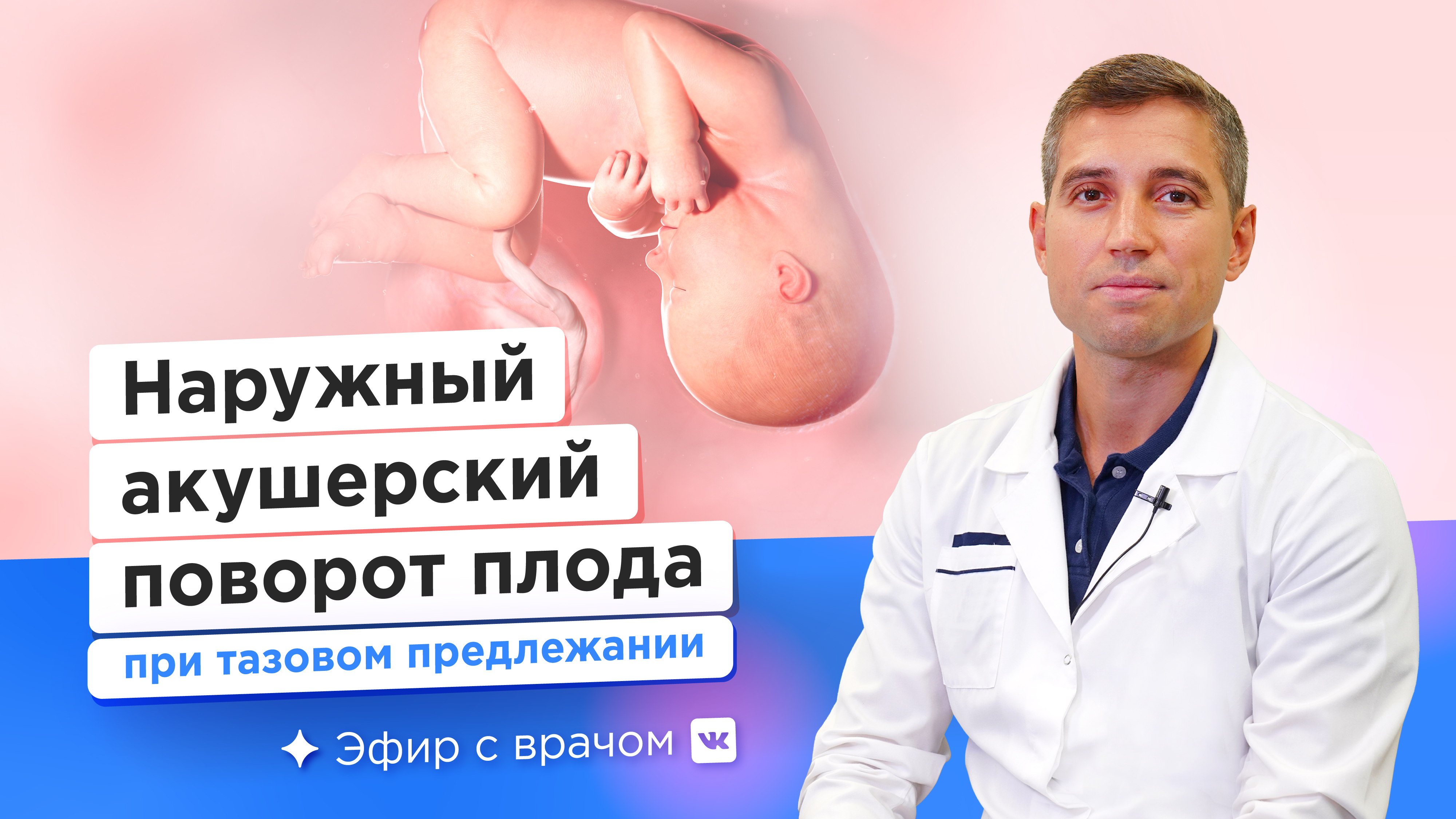 Наружный акушерский поворот при тазовом предлежании плода смотреть онлайн