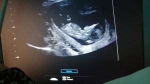 Первый скрининг