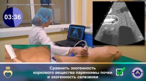 УЗИ левой почки