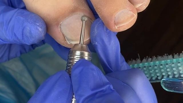 Мужской Педикюр (кусочки носка под ногтем?) смотреть онлайн