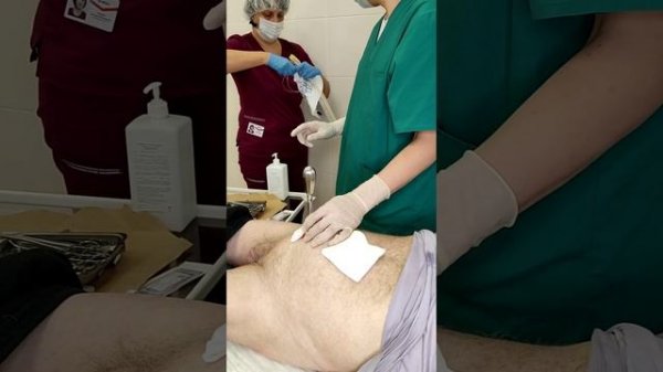 Троакарная эпицистостомия под местным обезболиванием