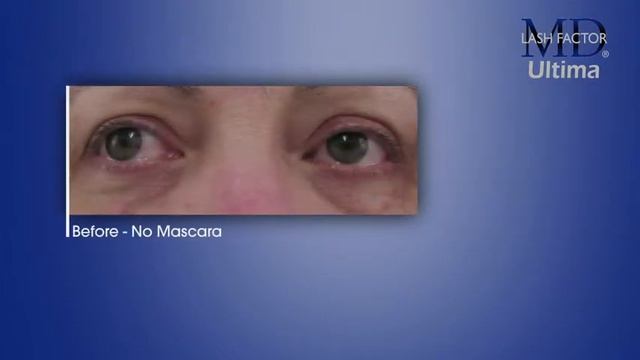 MD Lash Factor Ultima смотреть онлайн