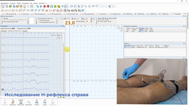 ЭНМГ диагностика вертеброгенной радикулопатии L5. Реальный клинический случай // EMGschool смотреть онлайн