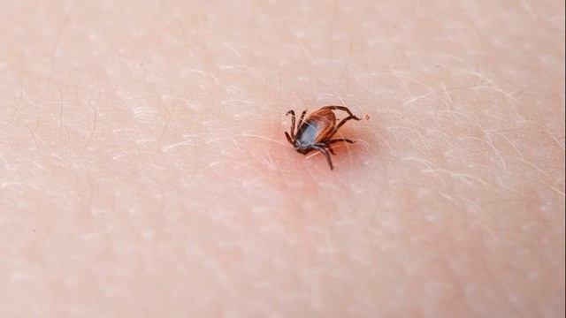 ОПАСНЫЙ КЛЕЩ | 13 симптомов боррелиоза которые нельзя пропустить смотреть онлайн