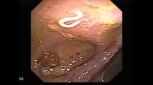 "Неизлечимых болезней нет" -Хильда Кларк