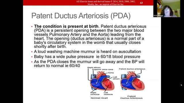 NUR203 Week 5 Respiratory and Cardiac Dysfunction смотреть онлайн