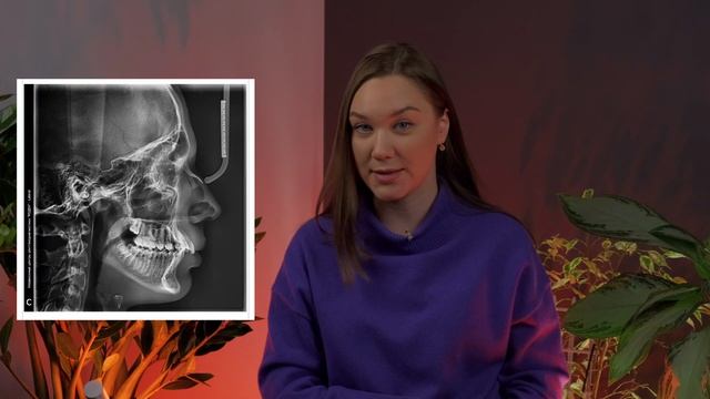 Первый визит к ортодонту. Чего ожидать? Ортодонт Eclinic Гурьева Ольга. смотреть онлайн