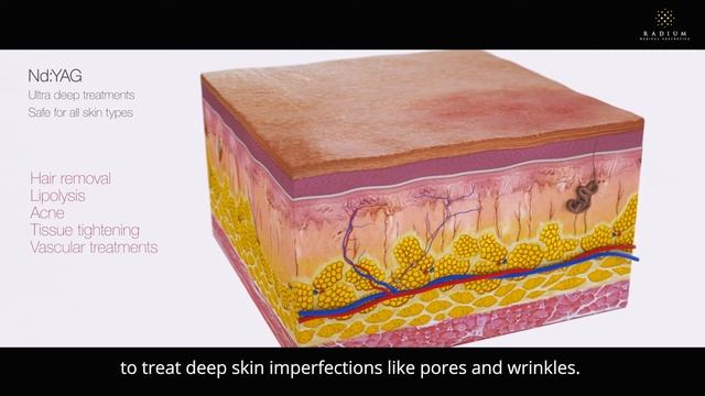 Non-Surgical Facelift Treatment With Fotona 4D and Ultherapy | Radium Medical Aesthetics смотреть онлайн