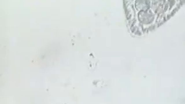 Движение инфузорий смотреть онлайн