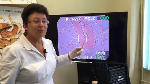 Холестеринемия и косметические средства. смотреть онлайн