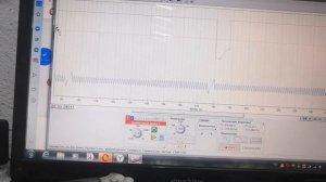 Ремонт Hyundai Getz. пропуски зажигания. коды ошибок OBDII P0300 P0301 P0302 P0303 P0304