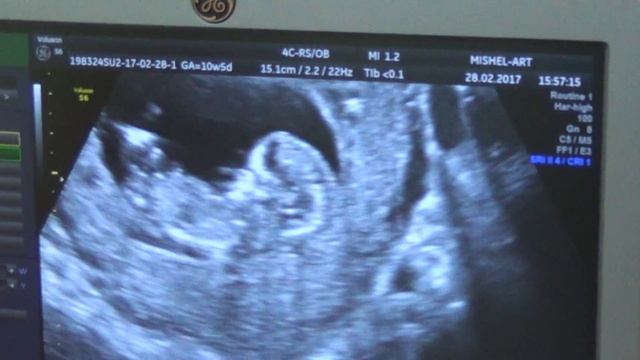 Козявка смотреть онлайн