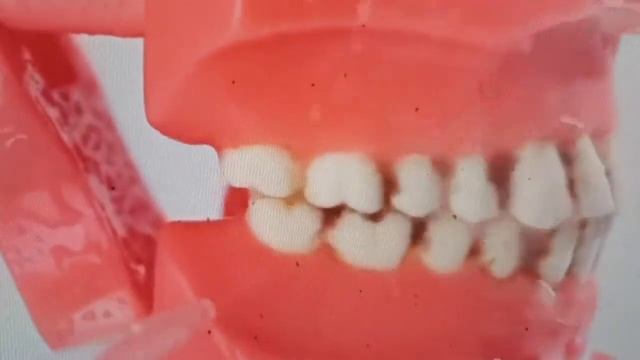 Waterpulse Dental Water Jet Flosser Irrigator Oral Dent Teeth Cleaner смотреть онлайн