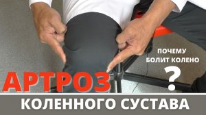 БОЛИТ КОЛЕНО. АРТРОЗ КОЛЕННОГО СУСТАВА. Почему? Что делать?