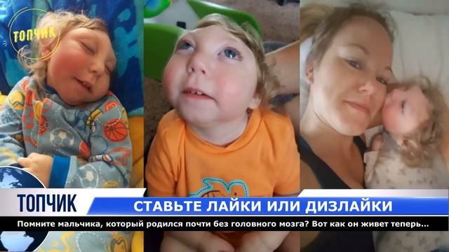 Помните мальчика, который родился без головного мозга Вот как он живет теперь!!! смотреть онлайн