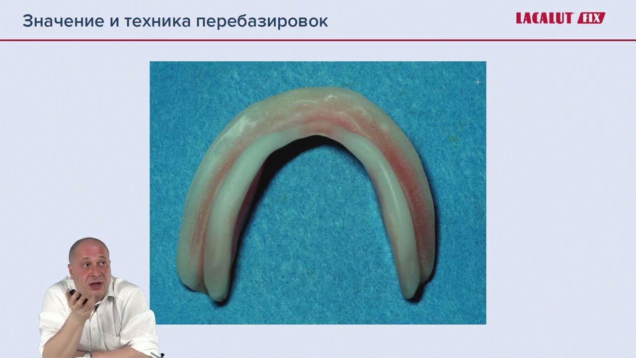 Полные съемные протезы  сложности, ошибки, нюансы. 3 часть
