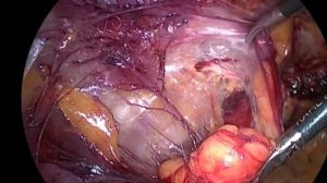 Анатомия паховой области у мужчины