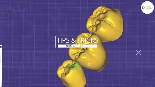 exocad course смотреть онлайн