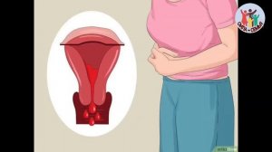 Вакти хомиладор шави Зан ва ПИСАР ё ДУХТАР ШУДАН САБАБХОИ АСОСИ