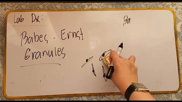 Corynebacterium spp. смотреть онлайн