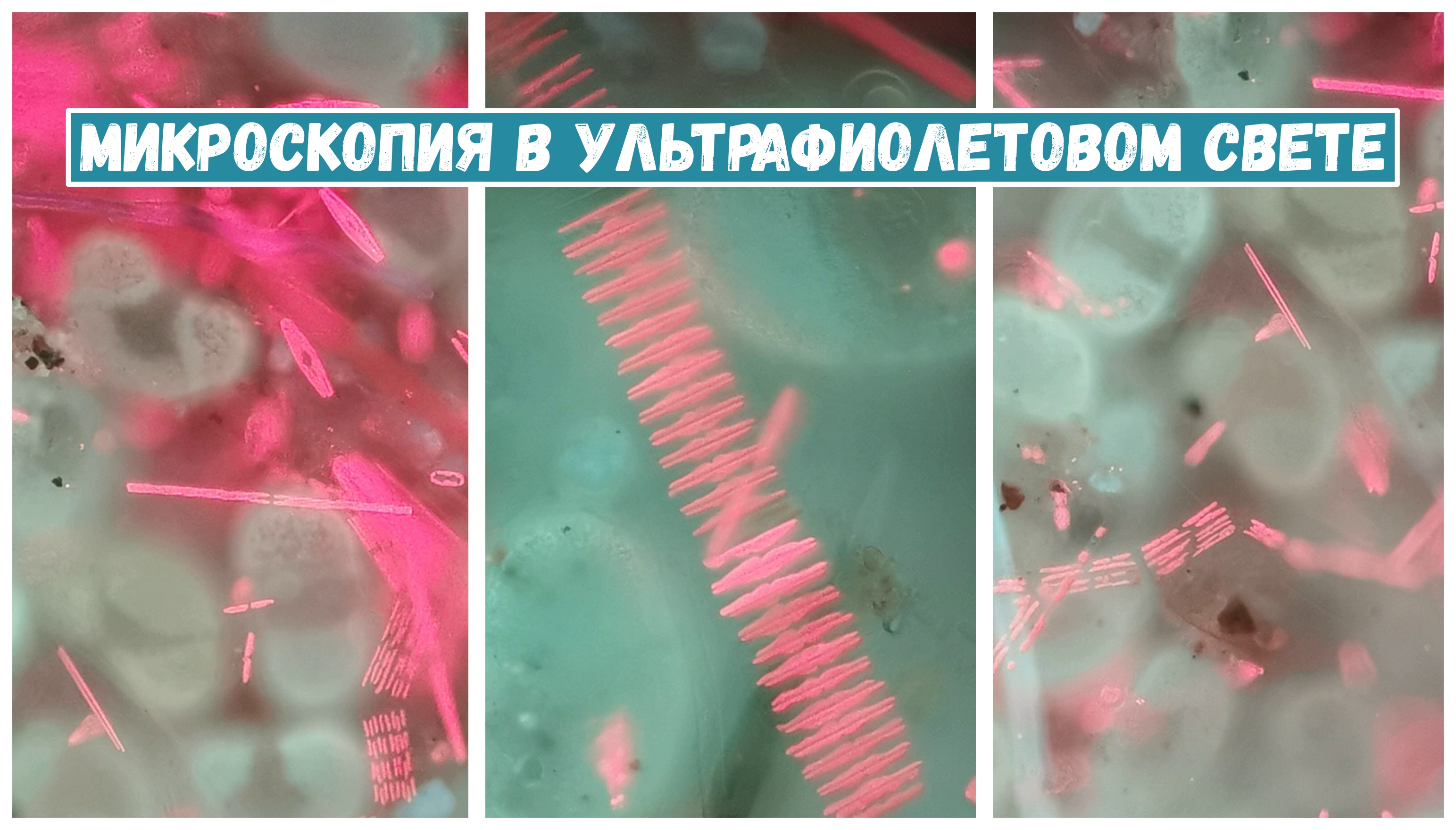 Что можно увидеть в капле воды из городского пруда? Часть 3. смотреть онлайн