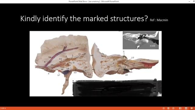 Trim17 смотреть онлайн