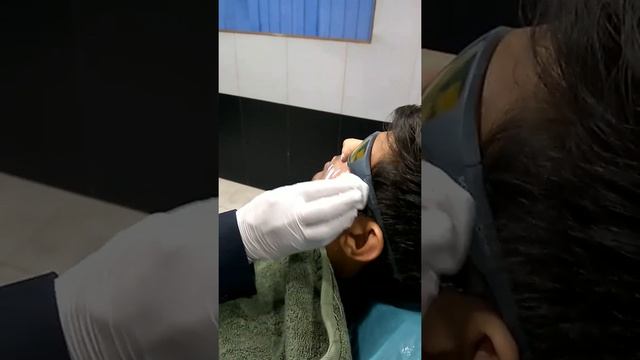 Acne scar treatment by Dr Neeraj Kumar MD смотреть онлайн