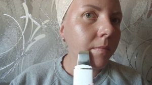 Ультразвуковой прибор для чистки лица OLZORI U-Sonic