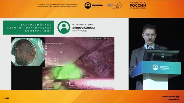 Случай лечения раннего рака желудка комбинированным эндоскопически-лапароскопическим доступом смотреть онлайн