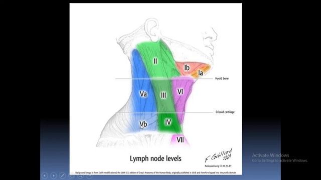 Cervical Lymphadenopathy ENT Lecture 4th yr 16-4-2020 смотреть онлайн