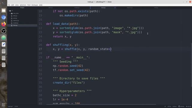 Retina Blood Vessel Segmentation using UNET in TensorFlow 2.0 (Keras) | Image Segmentation смотреть онлайн