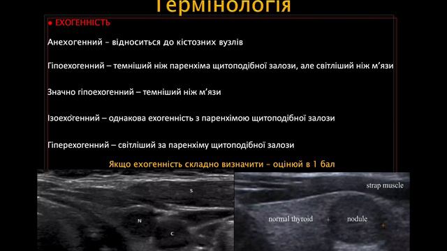 EU-TIRADS vs ACR TI-RADS: оцінка вогнищевих утворень щитоподібної залози смотреть онлайн