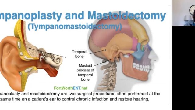 ENT Lecture - Ear Surgery смотреть онлайн