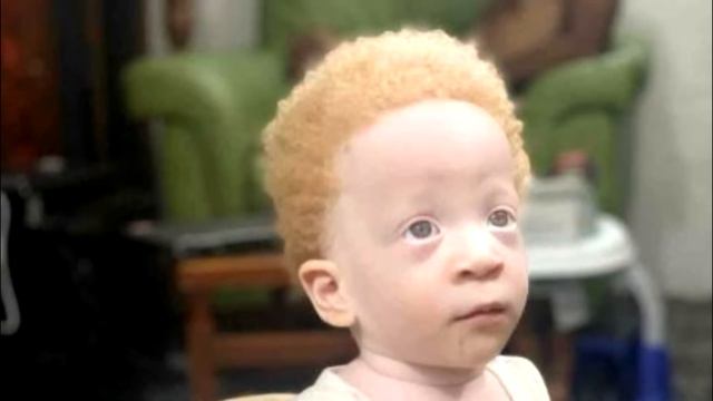 Помните близнецов разного цвета? Посмотрите как они живут сейчас! смотреть онлайн