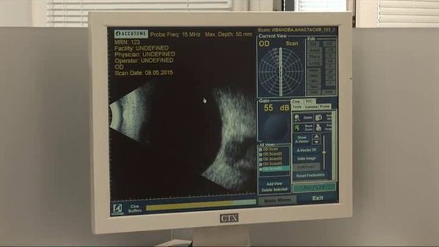 Современная диагностика зрения смотреть онлайн