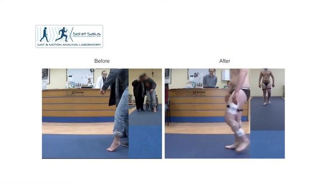 Neuro-ortopedia - Dr. Paolo Zerbinati al Laboratorio Analisi del Movimento смотреть онлайн