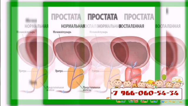 5 июня 2020 г.ФОРЕВЕР ЛИВИНГ ПРОДАКСТ АЛОЕ ВЕРА АРДЖИ ПЛЮС L- АРГИНИН. смотреть онлайн