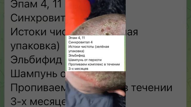 ВЫЛЕЧИЛИ СЕБОРЕЙНЫЙ ДЕРМАТИТ! #дерматит #себорейныйдерматит #дерматитудетей #дерматитлечение смотреть онлайн